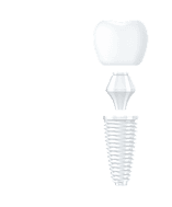 Один зуб за 40 минут Имплант Medentika + коронка